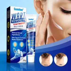 Wart Remover Ointment