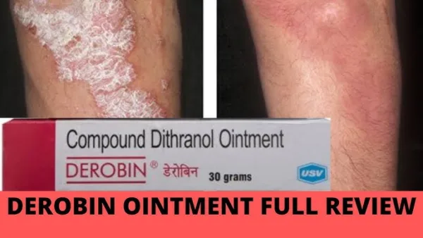 Compound Dithranol Ointment 30 GM (Derobin Cream) - Image 3