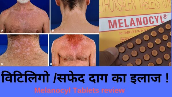 Melanocyl Tablet 10mg - Pack of 40 Tablets - Image 2