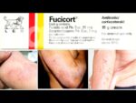 Fucicort Cream (Fusidic Acid/Betamethasone) - Image 4