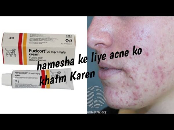 Fucicort Cream (Fusidic Acid/Betamethasone) - Image 3