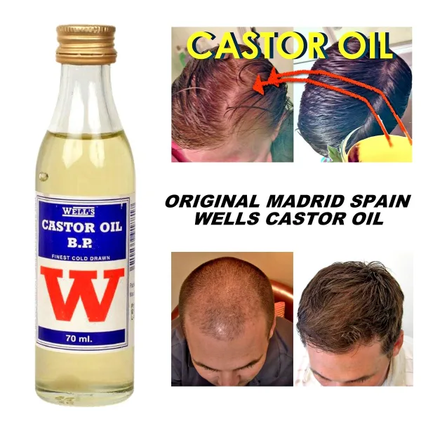 Castor Oil 70ml – Natural Multi-Purpose Oil for Hair, Scalp, Skin & Nails - Image 3