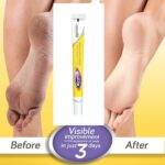 Scholl Krack Heel Repair Cream (Indian) 15g – Intensive Care for Dry, Rough & Cracked Heels - Image 2