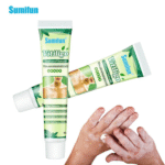 Sumifun Vitiligo Treatment Cream,Reduces White Spots on Skin, Pigmentation regulating, Improve Skin Pigmentation, Vitiligo Creams - Image 3