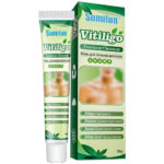 Sumifun Vitiligo Treatment Cream,Reduces White Spots on Skin, Pigmentation regulating, Improve Skin Pigmentation, Vitiligo Creams