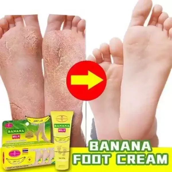 AICHUN BEAUTY 80gm Cracked Heel Cream Foot Care Banana Milk Cream Rough Dry Skin Baby Foot - Image 2