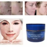 Anti Freckly Cream - Blue - 25gm - Image 2