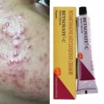 Betnovate-C Cream 30gm – Effective Relief for Inflamed Skin with Secondary Bacterial Infection - Image 3