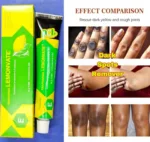 Lemonvate Cream 30gm (Italy) – Brightening & Moisturizing Cream for Healthy-Looking Skin - Image 2