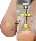 Manicure and pedicure tool set with storage case