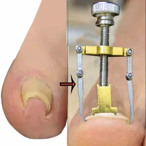 Manicure and pedicure tool set with storage case