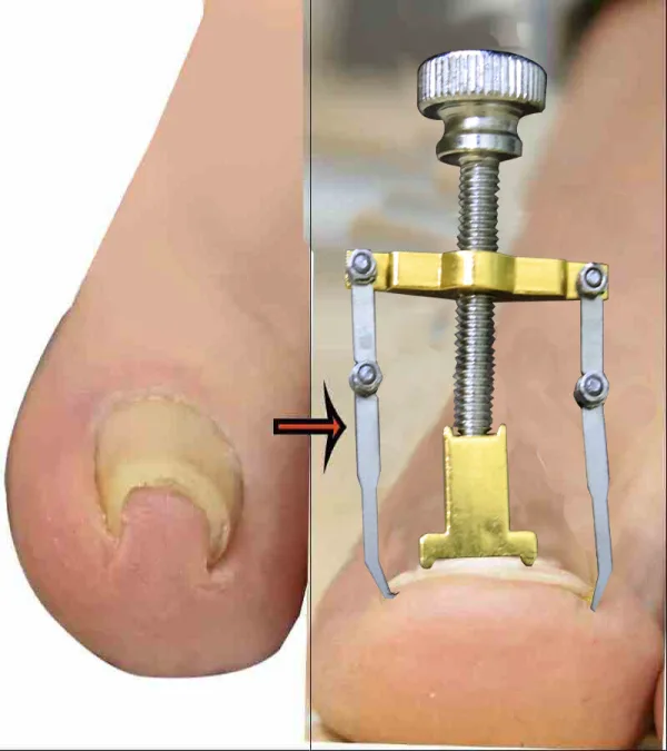 Manicure and pedicure tool set with storage case