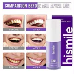 Hismile V34 non-invasive brightening treatment for yellow undertones