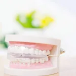 Dental teeth straightening trainer for teens and adults