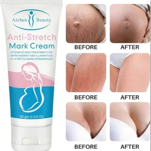 Aichun stretch mark repair massage cream 60g