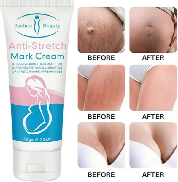 Aichun stretch mark repair massage cream 60g