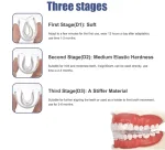 3-stage teeth trainer alignment braces in food-grade silicone