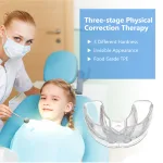 3-stage teeth trainer alignment braces in food-grade silicone