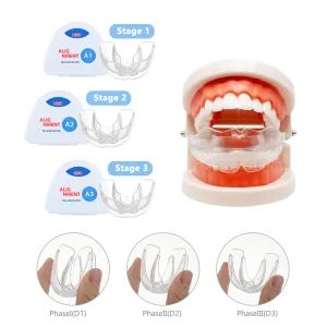 3-stage teeth trainer alignment braces in food-grade silicone