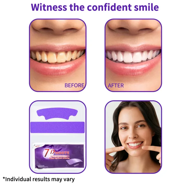 No sensitivity purple bleaching strip for instant teeth cleaning