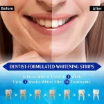 Box of 9D teeth whitening strips in mint flavour, 7 pairs