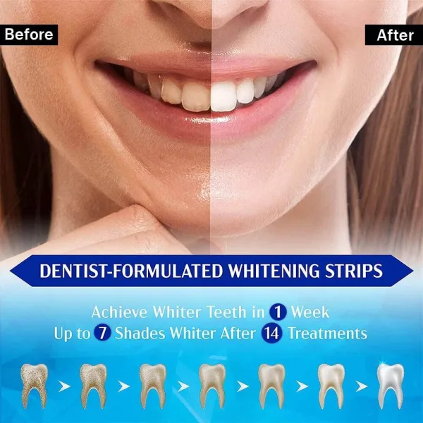 Box of 9D teeth whitening strips in mint flavour, 7 pairs