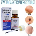 Duofilm salicylic acid and lactic acid solution 15ml for warts