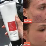 Salicylic acid BHA creamy foam cleanser for oily and congested skin