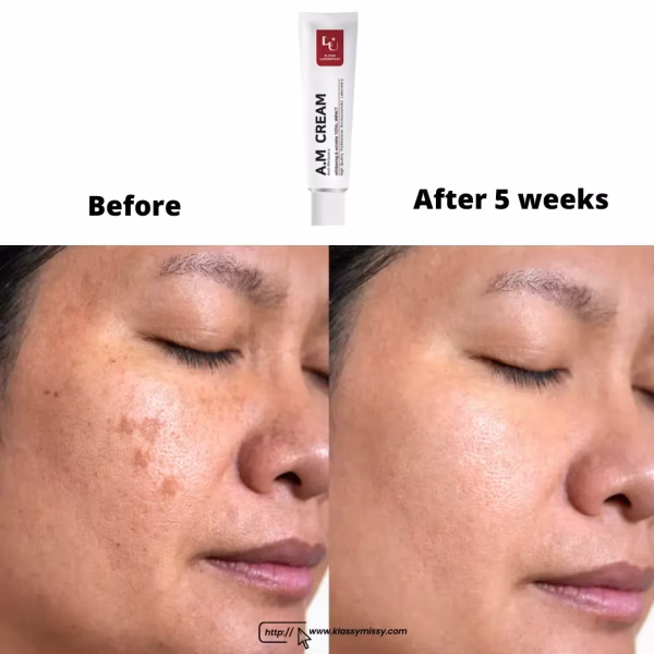 W. Skin Laboratory A.M Cream Anti Melasma 50ml - Image 3
